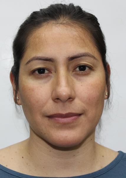 Lady Deniss LÓpez Morales