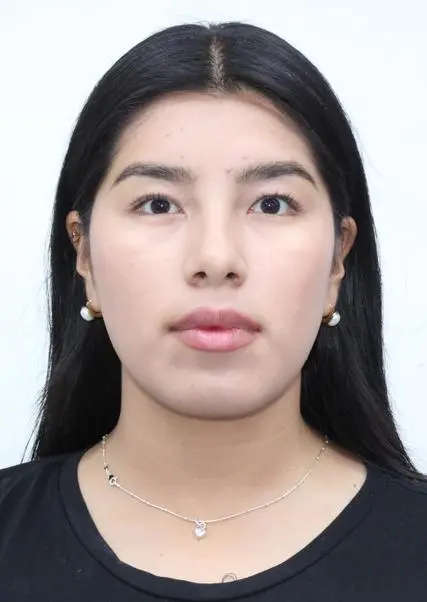ROSA XIOMARA