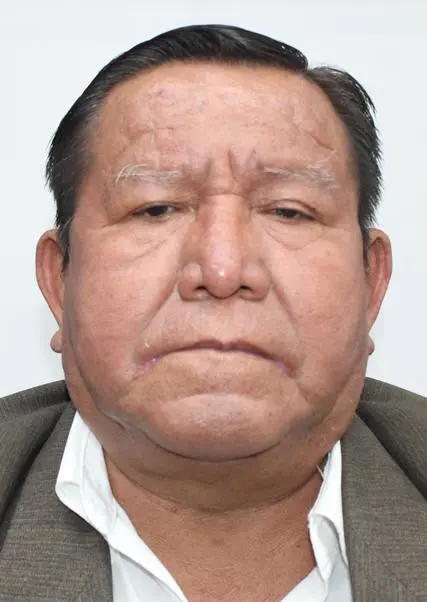 CESAR