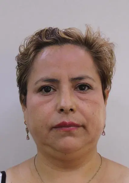 OLGA ESPERANZA