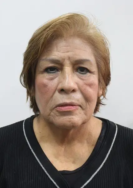 DURGA EDELMIRA