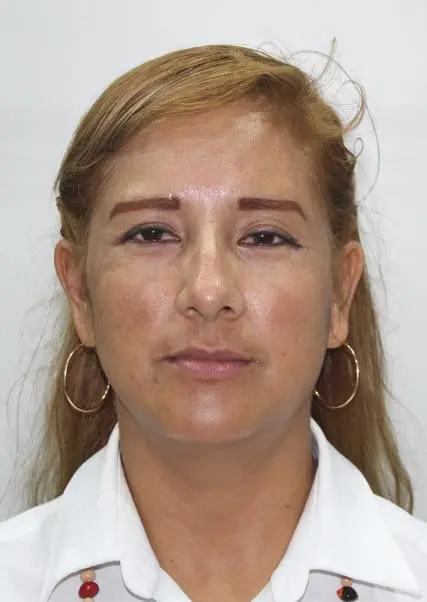 BROOKE DEL PILAR