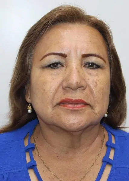 AIDA