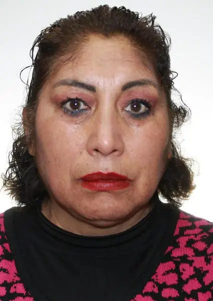 YRENE