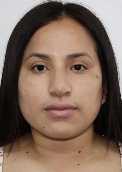 FLOR DEL ROSARIO
