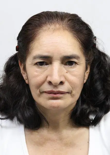 ELVIA
