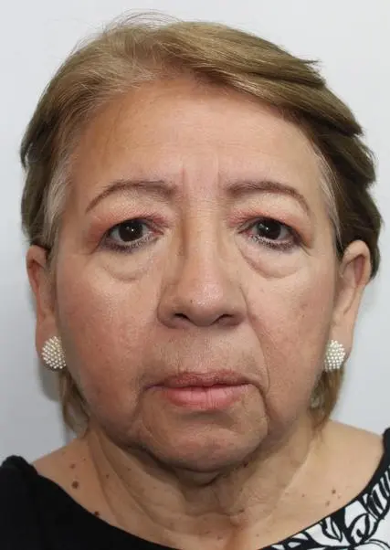 ROSA ELVIRA